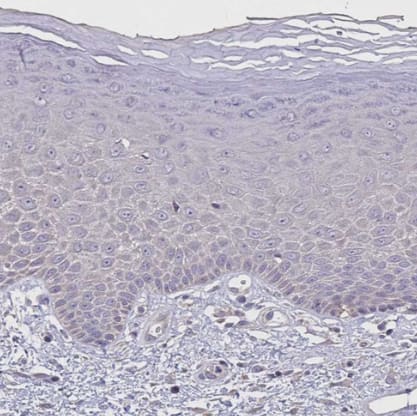Staining of human skin shows no positivity in squamous epithelial cells as expected.