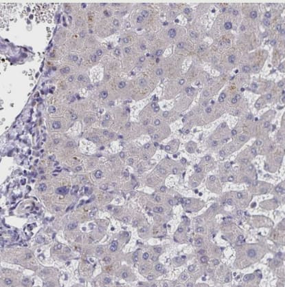 Staining of human liver shows no positivity in hepatocytes as expected.