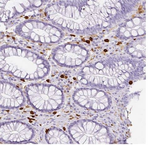 Immunohistochemistry-Paraffin: Hexokinase Type III Antibody [NBP2-38799] -Staining of human colon shows strong cytoplasmic positivity in lymphoid cells.