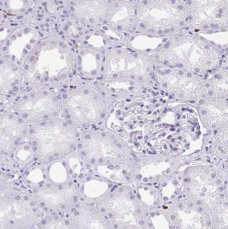 Immunohistochemistry-Paraffin: Hexokinase Type III Antibody [NBP2-38799] -Staining of human skin shows negative cytoplasmic positivity in squamous epithelial cells as expected.