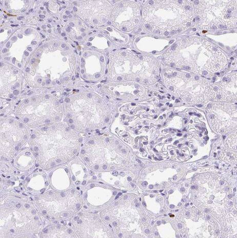 Immunohistochemistry-Paraffin: Hexokinase Type III Antibody [NBP2-38799] -Staining of human kidney shows negative cytoplasmic positivity in cells in tubules and cells in glomeruli as expected.