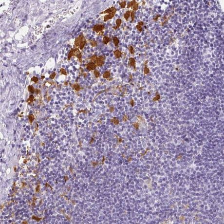 Immunohistochemistry-Paraffin: Hexokinase Type III Antibody [NBP2-38799] -Staining of human lymphoid tissues shows strong cytoplasmic positivity in non-germinal center cells.