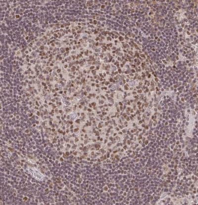 Immunohistochemistry-Paraffin DEK Antibody