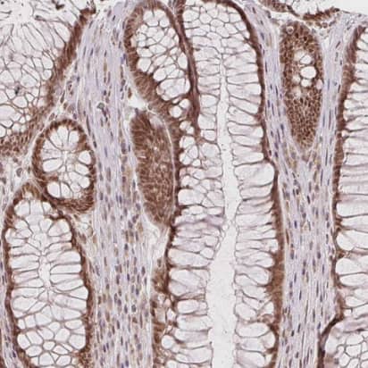 Immunohistochemistry-Paraffin: DEK Antibody [NBP2-38834] - Staining of human rectum shows strong nuclear positivity in glandular cells.