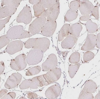 Immunohistochemistry-Paraffin: DEK Antibody [NBP2-38834] -Staining of human skeletal muscle shows moderate nuclear positivity in myocytes.