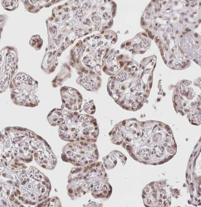 Immunohistochemistry-Paraffin: DEK Antibody [NBP2-38834] - Staining of human placenta shows moderate nuclear positivity in trophoblastic cells.