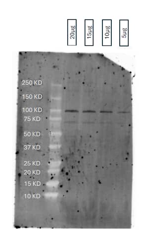 Western Blot: Rabbit Polyclonal ENPP-1 Antibody [NBP2-38945] - Western Blot on human valvular intersticial cell samples. Experiment used precast gel, migration at 190 V and a High weight transfer with the transblot. Then the membrane was blocked with BSA 5% for 1 hour and incubated overnight with ENPP-1 Antibody at 1/1000. The next day, after 3 washing we incubated the membrane with anti-rabbit at 1/1000 for 1h at room temperature. After 2 washing we imaged at 800nm. Image from a verified customer review.