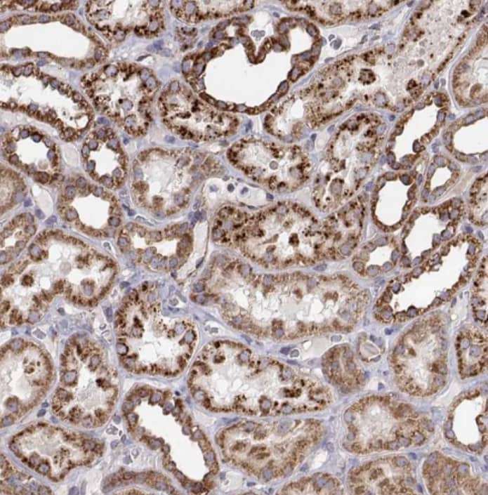Staining of human kidney shows strong granular cytoplasmic positivity in cells in tubules.