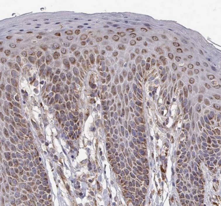 Staining of human skin shows strong granular cytoplasmic positivity in squamous epithelial cells.