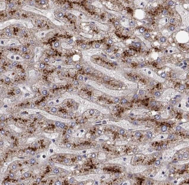  Staining of human liver shows strong granular cytoplasmic positivity in hepatocytes.
