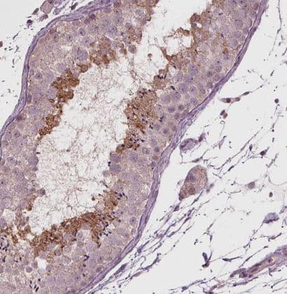 Immunohistochemistry-Paraffin: CXCL16 Antibody [NBP2-39072] - Staining of human testis shows moderate positivity in a subset of cells in seminiferous ducts.