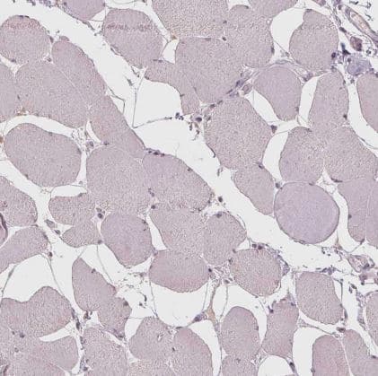 Immunohistochemistry-Paraffin: CXCL16 Antibody [NBP2-39072] - Staining of human skeletal muscle shows no positivity in myocytes as expected.