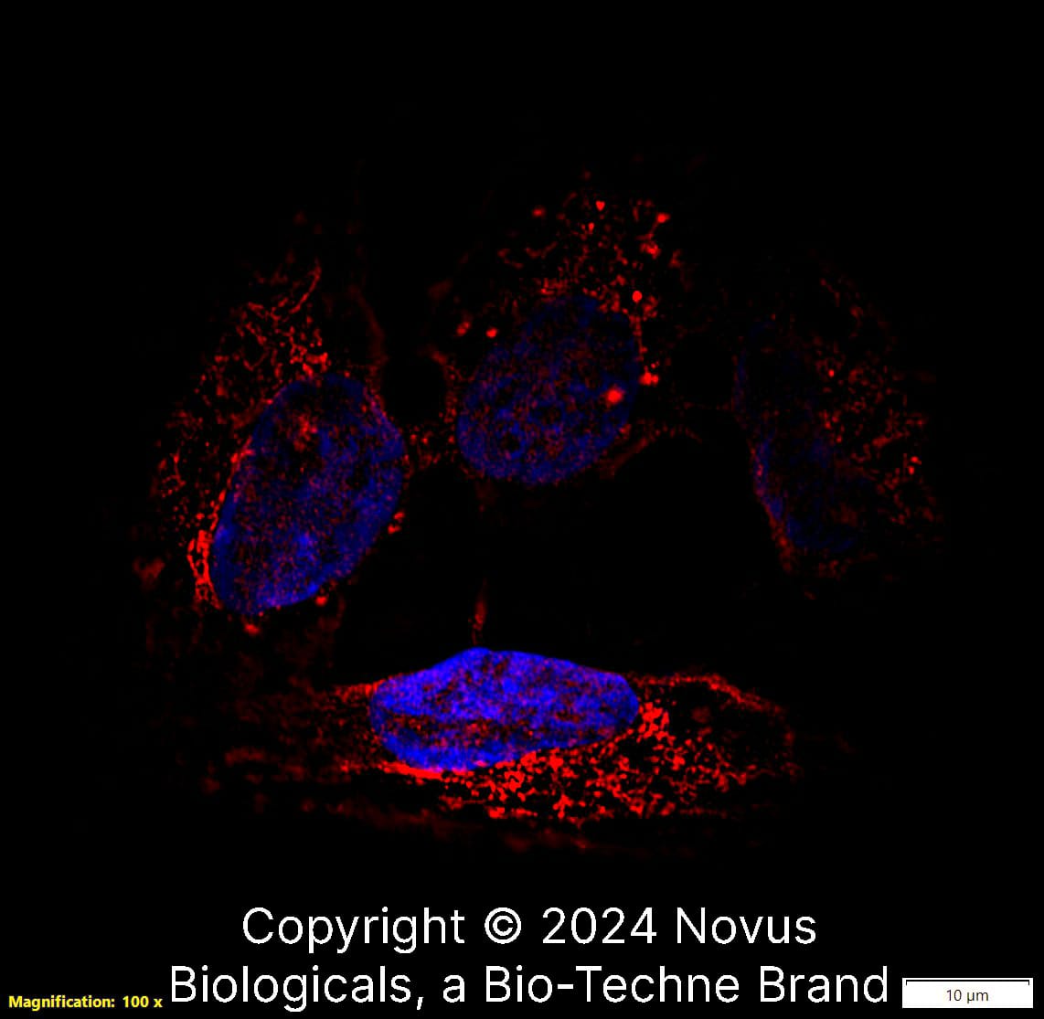 CD63 (H5C6) was detected in immersion fixed U-2 OS human osteosarcoma cell line using Mouse anti- CD63 (H5C6) Protein-G purified Monoclonal Antibody conjugated to Biotin (Catalog # NBP2-42225B) at 5 µg/mL overnight at 4C. Cells were stained using Streptavidin conjugated to DyLight 550 (red) and counterstained with DAPI (blue). Cells were imaged using a 100X objective and digitally deconvolved. 