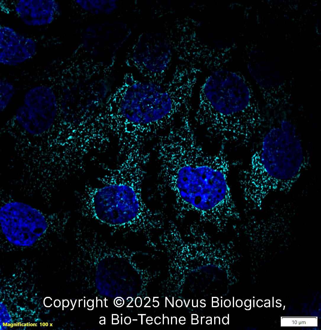 gp96/HSP90B1/GRP94 (CL2647) was detected in immersion fixed A431 human skin carcinoma cell line using Mouse anti-gp96/HSP90B1/GRP94 (CL2647) Protein A Purified Monoclonal Antibody conjugated to Alexa Fluor® 647 (Catalog # NBP2-42379) (light blue) at 2 µg/mL overnight at 4C. Cells were counterstained with DAPI (blue). Cells were imaged using a 100X objective and digitally deconvolved.