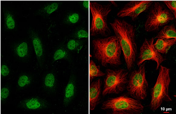 Immunocytochemistry/ Immunofluorescence: Nesprin 2 Antibody [NBP2-42886] -  HeLa cells were fixed in 4% paraformaldehyde at RT for 15 min.Green: Nesprin 2 stained by Nesprin 2 antibody [C3], C-term diluted at 1:2000.Red: alpha Tubulin, a cytoskeleton marker, stained by alpha Tubulin antibody [114] diluted at 1:1000.