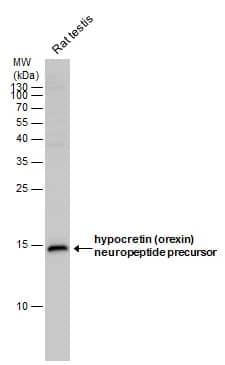 Western Blot: Rabbit Polyclonal Orexin B/Hypocretin-2 Antibody [NBP2-42905] - hypocretin (orexin) neuropeptide precursor antibody detects hypocretin (orexin) neuropeptide precursor protein by western blot analysis. Rat tissue extracts (50 μg) was separated by 15% SDS-PAGE, and the membrane was blotted with hypocretin (orexin) neuropeptide precursor antibody diluted at 1:1000. The HRP-conjugated anti-rabbit IgG antibody was used to detect the primary antibody.