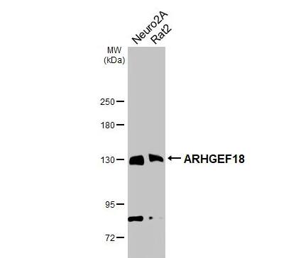 Western Blot: p114RhoGEF Antibody (1972) [NBP2-43546] - Various whole cell extracts (30 μg) were separated by 5% SDS-PAGE, and the membrane was blotted with ARHGEF18 antibody [1972] diluted at 1:1000. The HRP-conjugated anti-mouse IgG antibody (NBP2-19382) was used to detect the primary antibody.