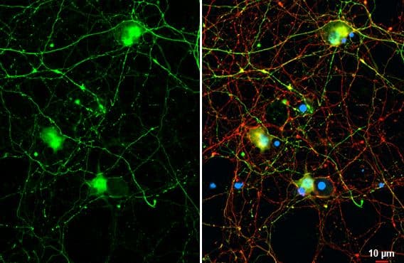 Immunocytochemistry/Immunofluorescence: GABA Antibody [NBP2-43558] - DIV9 rat E18 primary cortical neuron cells were fixed in 4% paraformaldehyde at RT for 15 min.Green: GABA stained by GABA antibody diluted at 1:250. Red: Tau, a axon marker, stained by Tau antibody [287] diluted at 1:500. Blue: Fluoroshield with DAPI. 