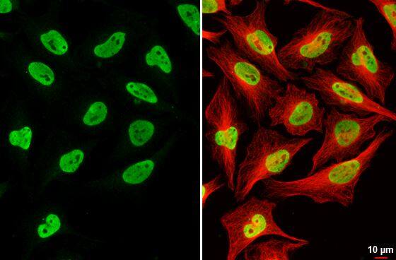 ICC/IF-RNASEH2B Antibody (479) [NBP2-43775] -  HeLa cells were fixed in 4% paraformaldehyde at RT for 15 min.Green: RNaseH2B stained by RNaseH2B antibody [479] diluted at 1:500.Red: beta Tubulin, a cytoskeleton marker, stained by beta Tubulin antibody diluted at 1:1000.