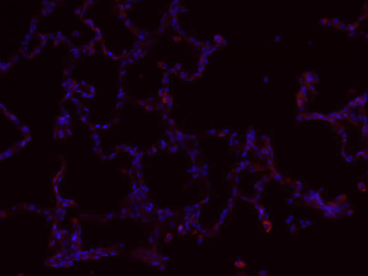 Immunohistochemistry: Mouse Monoclonal EpCAM/TROP1 Antibody (EGP40/1110) - (ECD) [NBP2-44635] - EpCAM/TROP1 signal in lung alveoli. Analysis in postfixed macaque lung tissue at a 1:100 concentration. Image from a verified customer review.