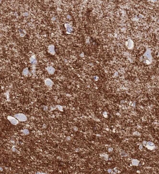 Immunohistochemistry-Paraffin LRRC37A Antibody - BSA Free