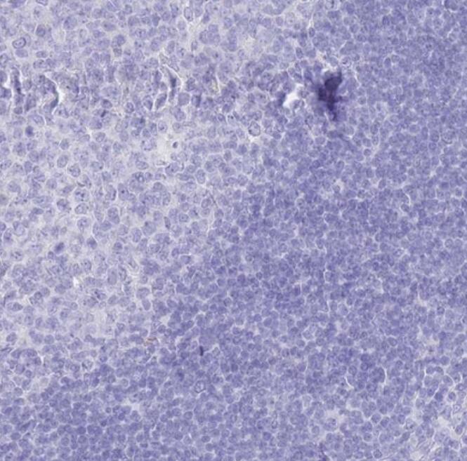 Immunohistochemistry-Paraffin LRRC37A Antibody - BSA Free