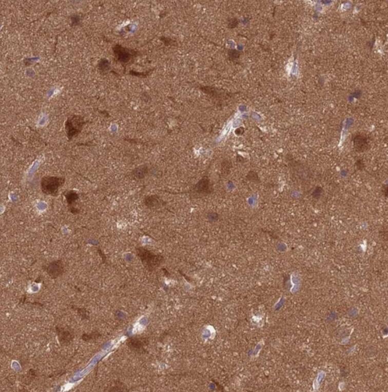  Staining of human cerebral cortex shows strong cytoplasmic positivity in neuronal cells and neuropil.