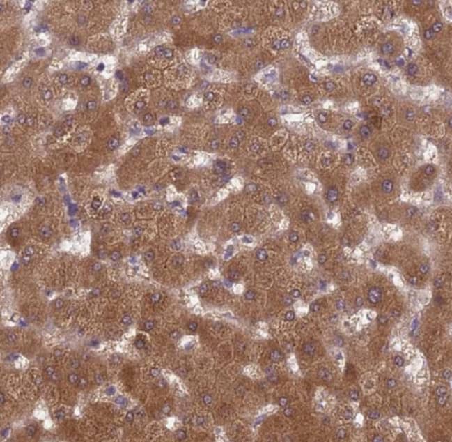  Staining of human liver shows strong cytoplasmic positivity in hepatocytes.