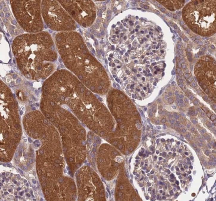 Staining of human kidney shows strong cytoplasmic positivity in cells in proximal tubules.