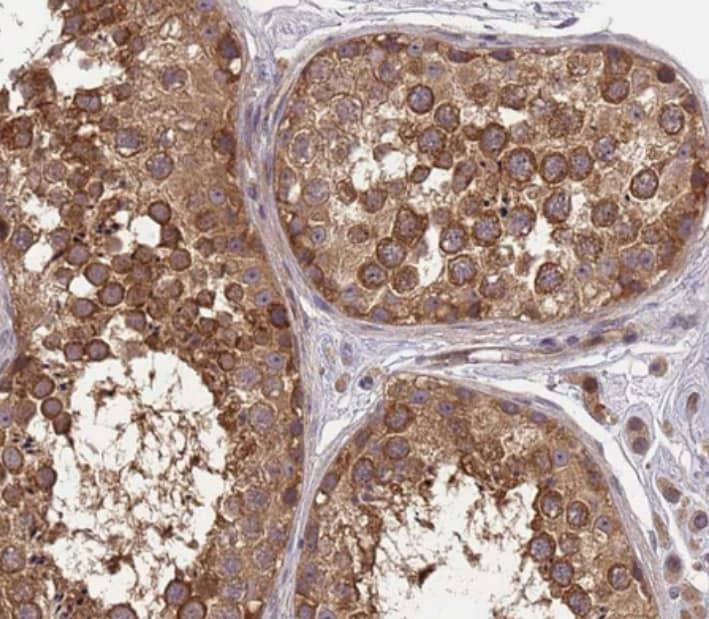 Staining of human testis shows strong cytoplasmic positivity in cells in seminiferous ducts.