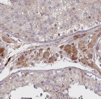 Immunohistochemistry: TWEAK/TNFSF12 Antibody [NBP2-46811] -Staining of human testis shows strong cytoplasmic positivity in Leydig cells.