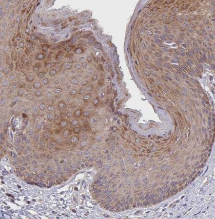 Immunohistochemistry: TWEAK/TNFSF12 Antibody [NBP2-46811] - Staining of human skin shows strong cytoplasmic positivity in squamous epithelial cells.