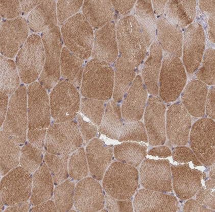 Immunohistochemistry: TWEAK/TNFSF12 Antibody [NBP2-46811] - Staining of human skeletal muscle shows strong cytoplasmic positivity in myocytes.