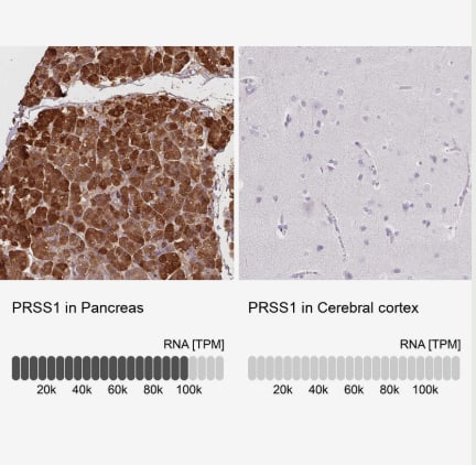 Immunohistochemistry-Paraffin Trypsin 1/PRSS1 Antibody