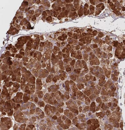 <b>Orthogonal Strategies Validation. </b>Immunohistochemistry-Paraffin: Trypsin 1/PRSS1 Antibody [NBP2-46871] -Staining of human pancreas shows strong cytoplasmic positivity in exocrine glandular cells.