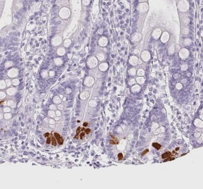 Immunohistochemistry-Paraffin: Trypsin 1/PRSS1 Antibody [NBP2-46871] -Staining of human duodenum shows strong cytoplasmic positivity in Paneth cells.