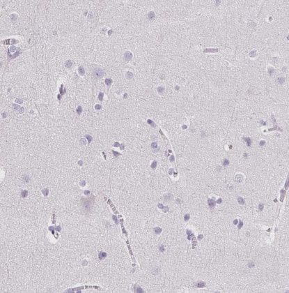 Immunohistochemistry-Paraffin: Trypsin 1/PRSS1 Antibody [NBP2-46871] -Staining of human cerebral cortex shows no positivity in neuronal cells as expected.