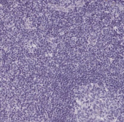 Immunohistochemistry-Paraffin: Trypsin 1/PRSS1 Antibody [NBP2-46871] -Staining of human tonsil shows no positivity in non-germinal center cells as expected.