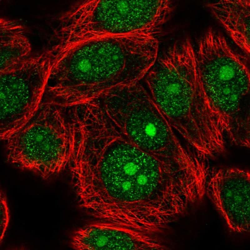 Staining of human cell line MCF7 shows positivity in the nucleus & nucleoli.