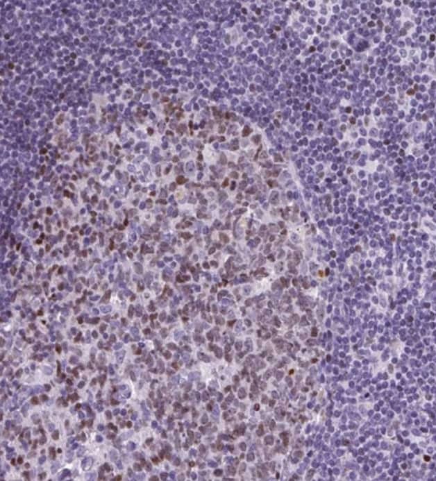 Immunohistochemistry-Paraffin SPC24 Antibody - BSA Free