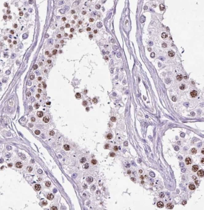 Immunohistochemistry-Paraffin SPC24 Antibody - BSA Free