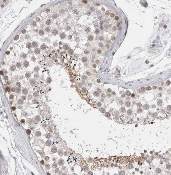 Immunohistochemistry-Paraffin RECQL4 Antibody - BSA Free