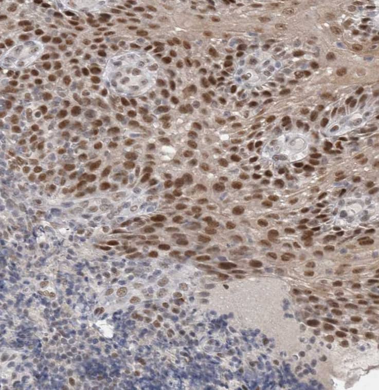 Immunohistochemistry-Paraffin RECQL4 Antibody - BSA Free