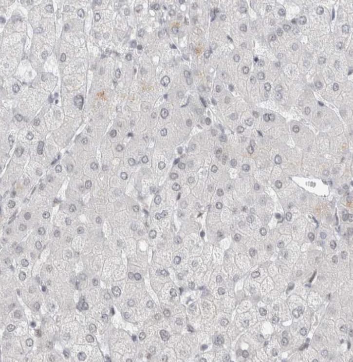  Staining of human liver shows no positivity in hepatocytes as expected.