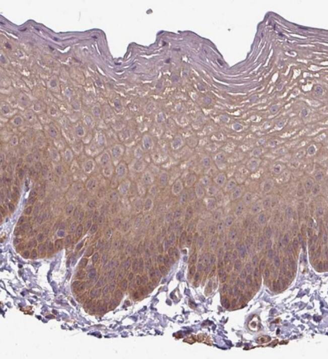 Staining of human skin shows moderate cytoplasmic positivity in squamous epithelial cells.