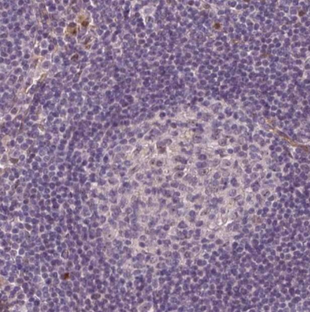 Staining of human lymph node shows no positivity in germinal center cells as expected.