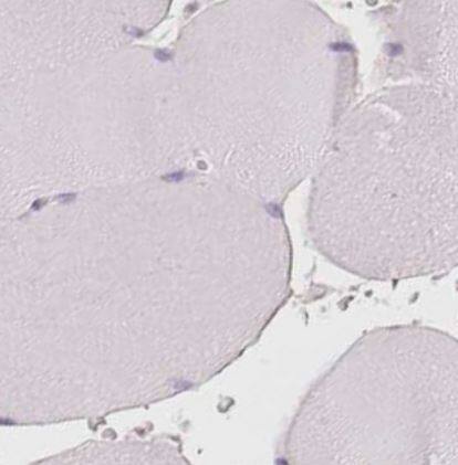 Immunohistochemistry-Paraffin: PDXDC1 Antibody [NBP2-47336] -Staining of human skeletal muscle shows no positivity in myocytes as expected.