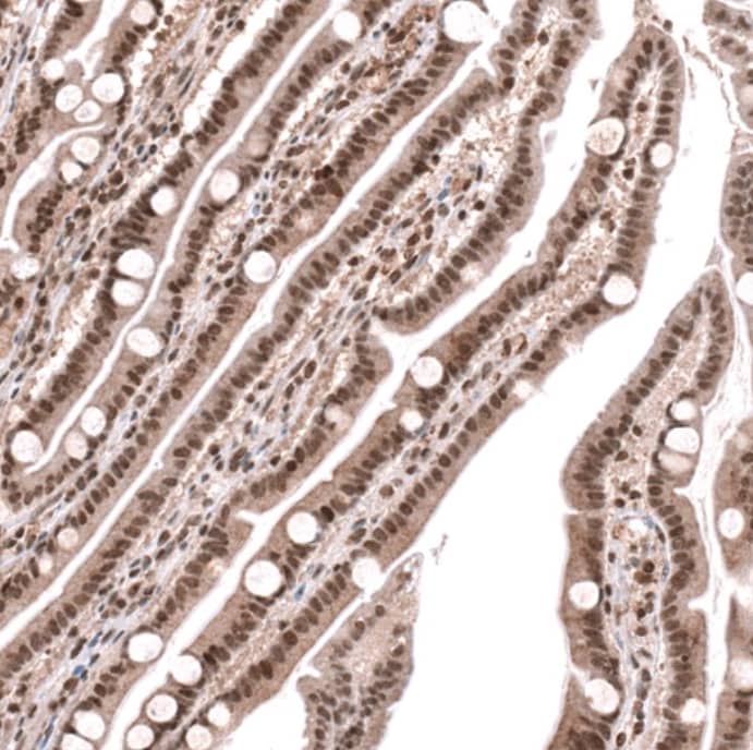 Staining of human duodenum shows strong nuclear positivity in glandular cells.