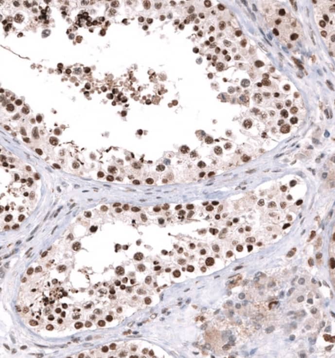 Staining of human testis shows moderate to strong nuclear positivity in cells in seminiferous ducts.