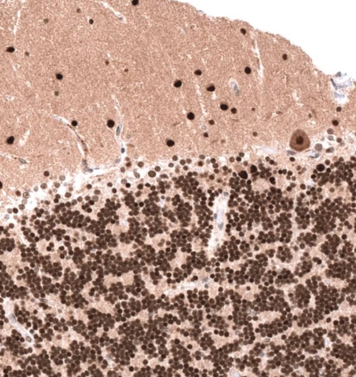 Staining of human cerebellum shows strong nuclear positivity in cells in granular and molecular layers, as well as in Purkinje cells.